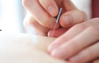 成人恶心针灸手法图解视频,针灸缓解成人恶心手法图解视频概述