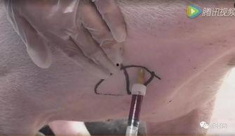 成人腹股沟静脉采血视频